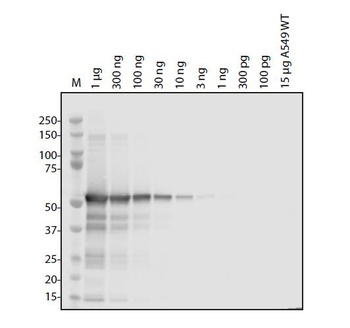 ORF1ab Antibody