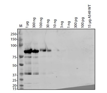 SARS-CoV-2 (COVID-19) NSP15 Antibody