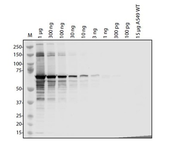 SARS-CoV-2 (COVID-19) Spike Antibody