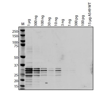 SARS-CoV-2 (COVID-19) ORF7A Antibody