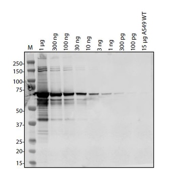 SARS-CoV-2 (COVID-19) Spike RBD domain Antibody
