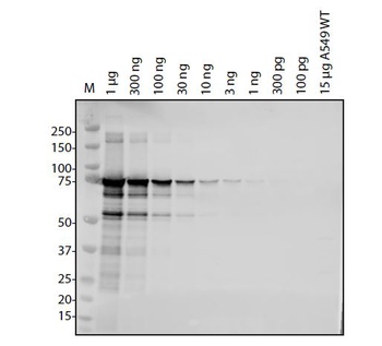 SARS-CoV-2 (COVID-19) NSP3 (743 - 1072) Antibody
