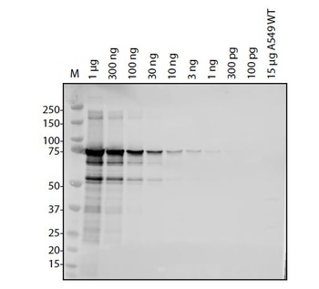 ORF1ab Antibody