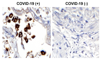 SARS-CoV-2 (COVID-19) Nucleocapsid Antibody [NP1189]