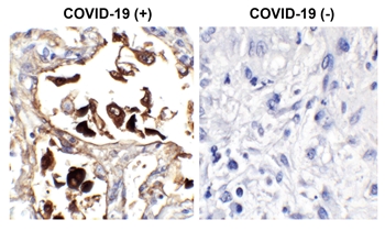 SARS-CoV-2 (COVID-19) Nucleocapsid Antibody [NP642]