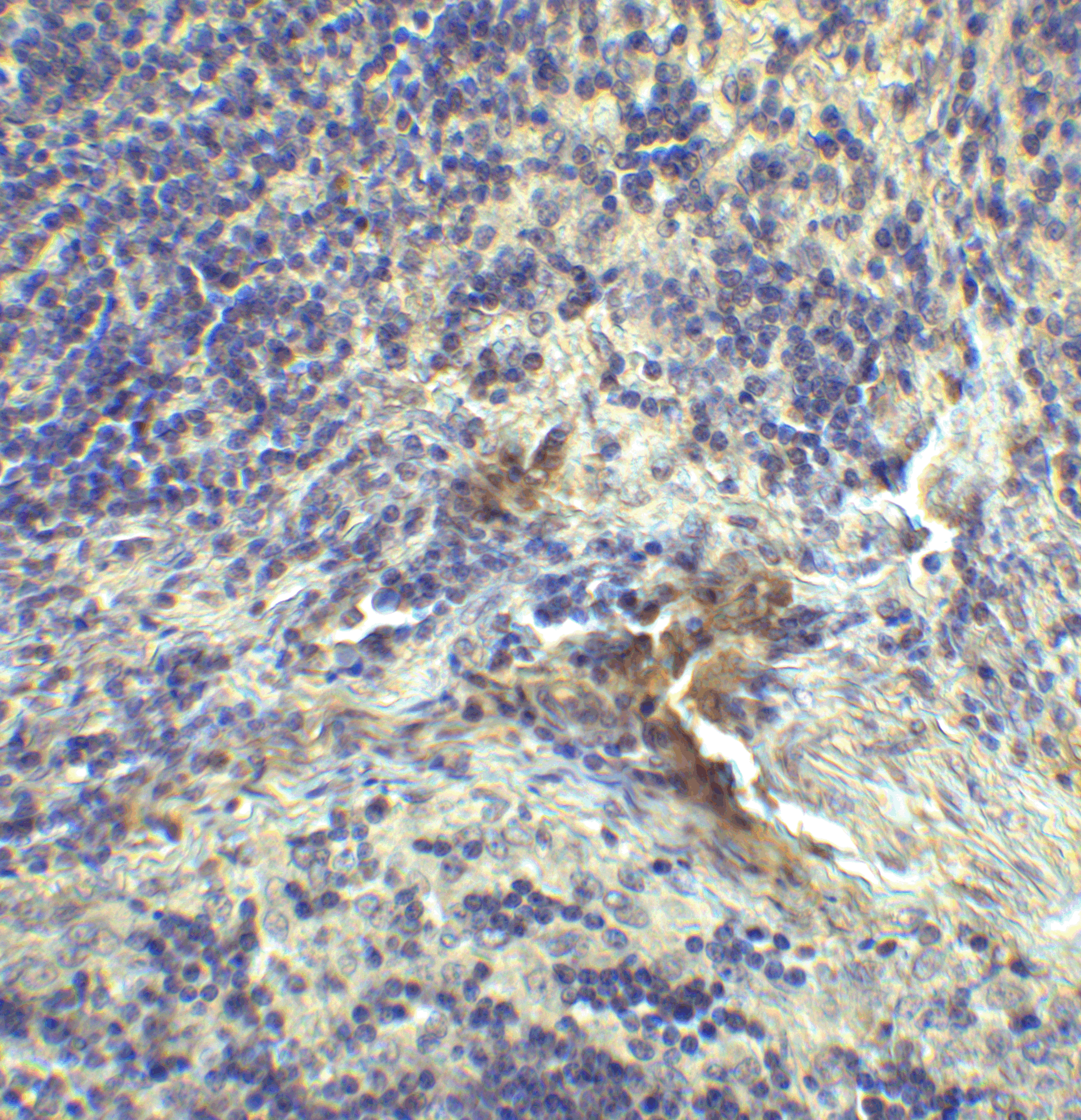 LAG-3 Single Domain Antibody [1C6]