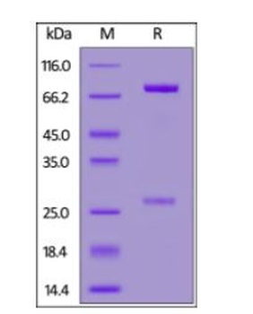 SARS-CoV-2 Spike RBD Neutralizing Antibody, monoclonal, Chimeric