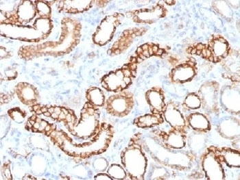 Recombinant Cadherin 16 Antibody [CDH16/1532R]