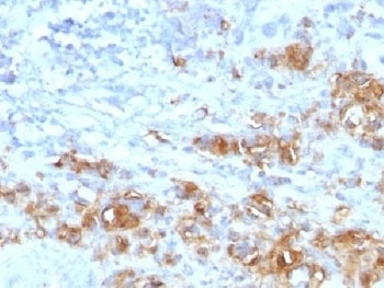 Recombinant CA19-9 Antibody [CA19.9/1390R]