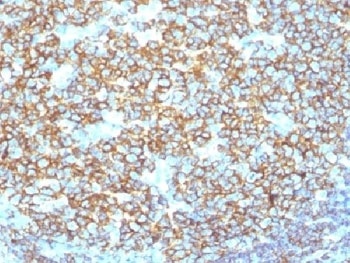 MS4A1 Antibody