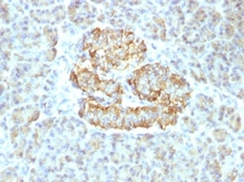 TNF Antibody
