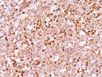 CD79A Antibody