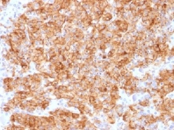 Recombinant Chromogranin A Antibody [CHGA/1773R]