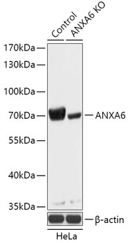 ANXA6 Antibody