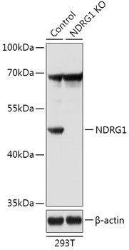 NDRG1 Antibody