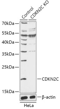CDKN2C Antibody