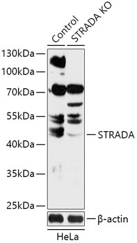 STRADA Antibody