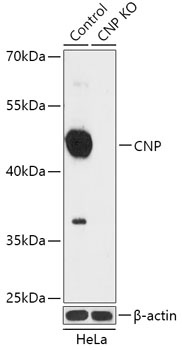 CNP Antibody