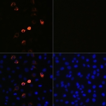 SARS-CoV-2 (COVID-19) Spike Antibody [ARC2373]