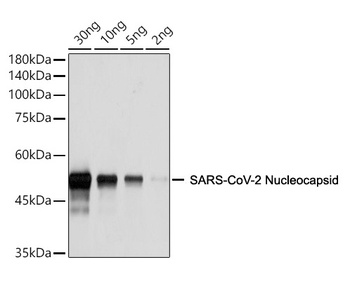 SARS-CoV-2 (COVID-19) Nucleocapsid Antibody [ARC2372]