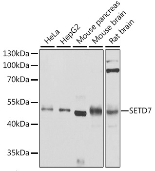 SETD7 Antibody
