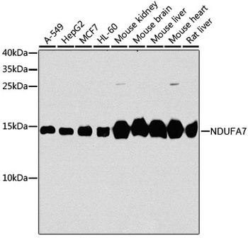 NDUFA7 Antibody, KO Validated