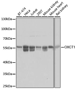 OXCT1 Antibody