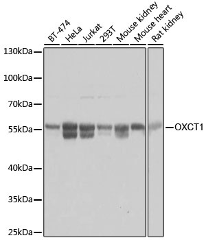 OXCT1 Antibody, KO Validated