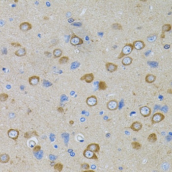 PFKP Antibody