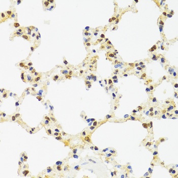 SUZ12 Antibody