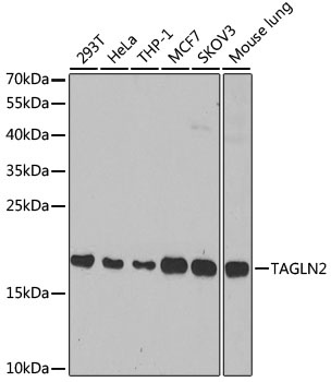 TAGLN2 Antibody