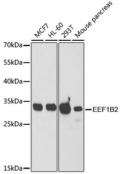 EEF1B2 Antibody, KO Validated
