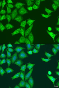 EIF2AK2 Antibody