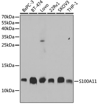 S100A11 Antibody, KO Validated