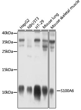 S100A6 Antibody