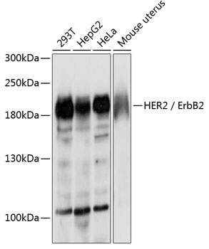 ErbB2 Antibody