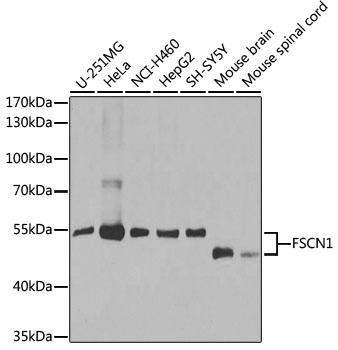 FSCN1 Antibody, KO Validated
