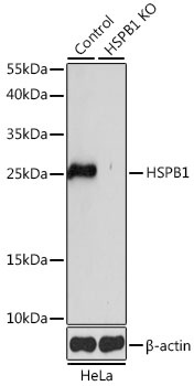HSPB1 Antibody