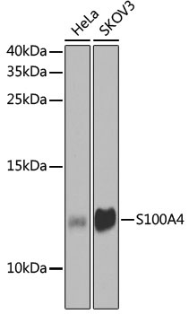S100A4 Antibody, KO Validated