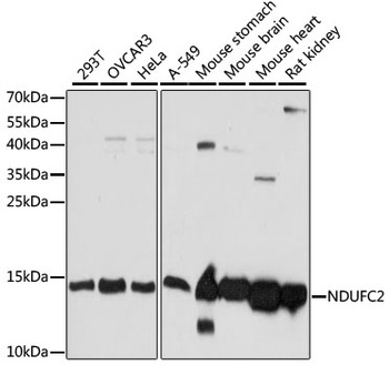 NDUFC2 Antibody, KO Validated