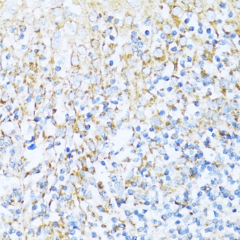 NDUFA5 Antibody