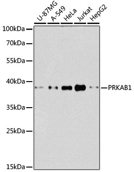 PRKAB1 Antibody, KO Validated