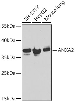 ANXA2 Antibody, KO Validated