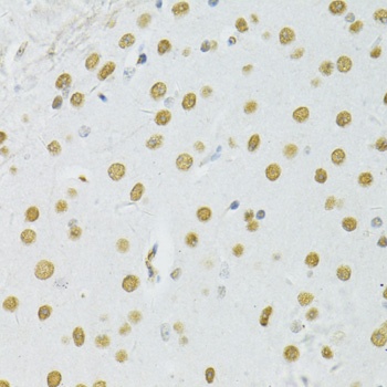BAX Antibody, KO Validated