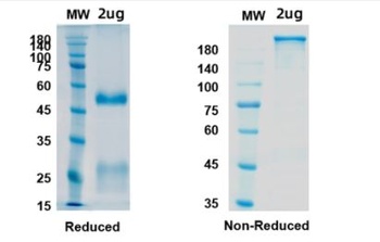 Recombinant SARS-CoV-2 (COVID-19) RBD Neutralizing antibody [AbE450]