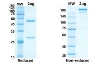 Recombinant SARS-CoV-2 (COVID-19) Nucleocapsid antibody [AbG733]