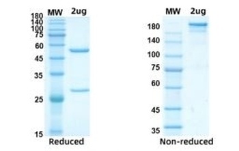 Recombinant SARS-CoV-2 (COVID-19) Nucleocapsid antibody [AbD207]