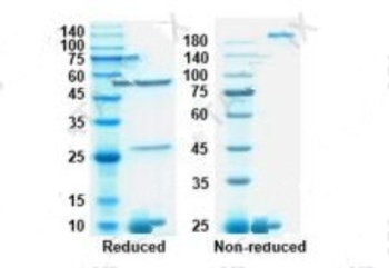 Recombinant SARS-CoV-2 RBD antibody