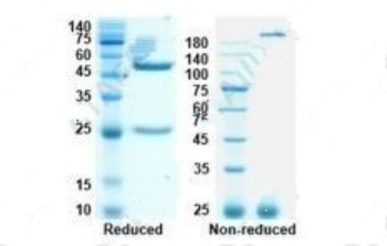 Recombinant SARS-CoV-2 S-NTD antibody