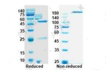 Recombinant SARS-CoV-2 RBD antibody